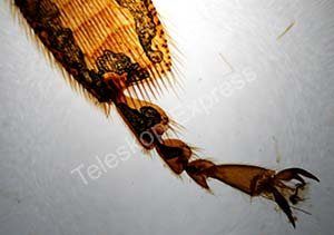 TS-Optics ZOOLOGIE / Tiere Dauerpräparate für Mikroskope - 25 Stück in Holzbox (mit deutscher Übersetzung der Inhaltsangabe), .. Beispielbilder aus dem Inhalt, TSMDPZ - 2